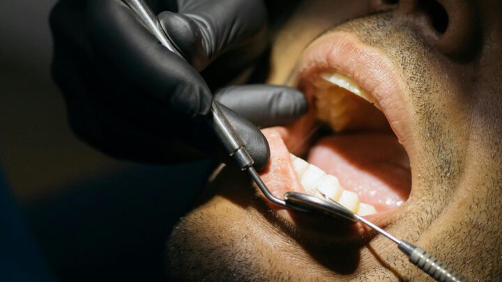 La periodontitis, una amenaza silenciosa para los diabéticos