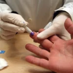 EE.UU. registra un aumento récord de casos de sífilis en 70 años