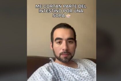 Joven llega al hospital tras consumir sopa instantánea: le tuvieron que cortar parte del intestino