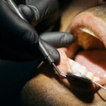 La periodontitis, una amenaza silenciosa para los diabéticos