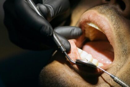 La periodontitis, una amenaza silenciosa para los diabéticos