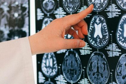 ¿Realmente los teléfonos móviles aumentan el riesgo de cáncer cerebral? Esto dice la OMS