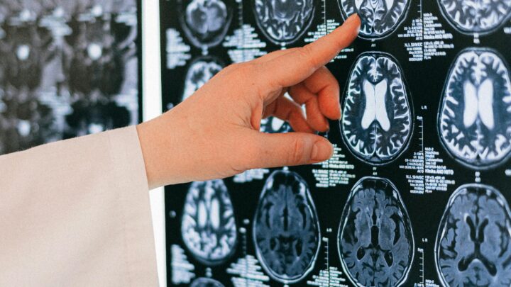 ¿Realmente los teléfonos móviles aumentan el riesgo de cáncer cerebral? Esto dice la OMS