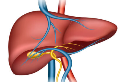 Hígado graso no alcohólico: síntomas, riesgos y cómo prevenirlo